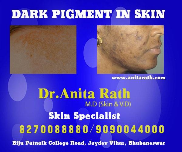 best skin treatment clinic in bhubaneswar, odisha